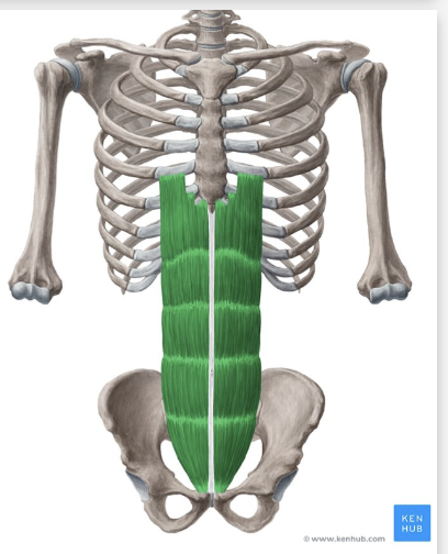 <p>What structure is depicted in green?</p>