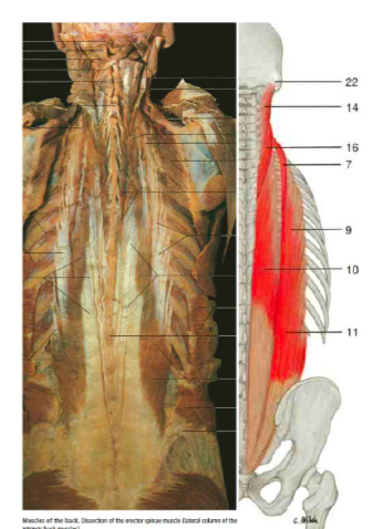 <p>Deep muscles of the back</p>