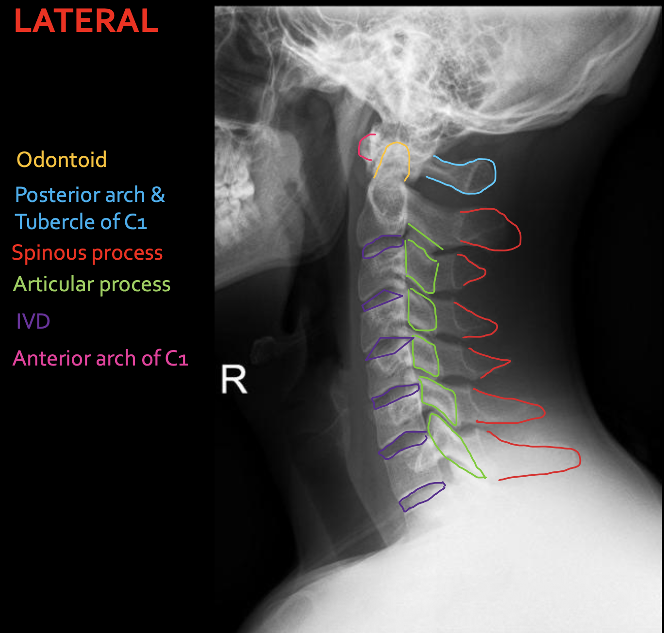 <p><strong>Articular process</strong></p>