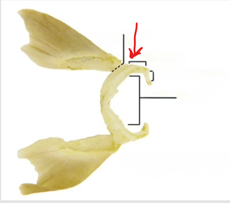 <p>The dorsal, distal part of the pectoral girdle that articulates with the pectoral fin</p>
