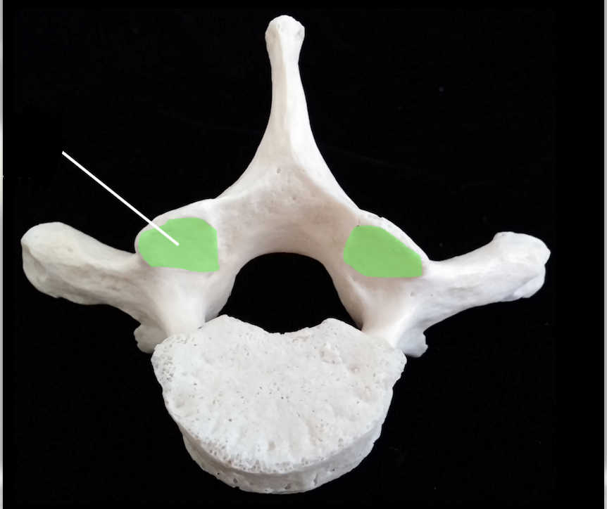 <p>what bone is the highlighted green area ? </p>