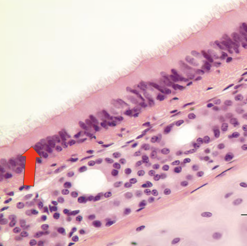 <p>Identify the highlighted structure</p>