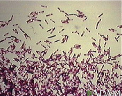 <p>what bacteria refers to a toxin producing anaerobic gram positive rod?</p>