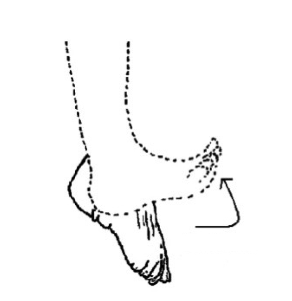 <p>name the muscle action</p>