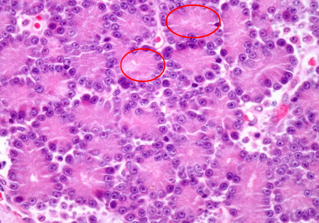 <p>What are the red circles pointing to?</p>