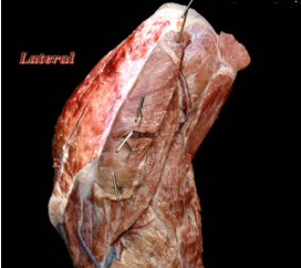 <ol><li><p>origin</p></li></ol><p>supraspinous fossa</p><ol start="2"><li><p>insertion</p></li></ol><p>greater tubercle</p><ol start="3"><li><p>action</p></li></ol><p>extends shoulder joint</p><p>primary stabilizer of the lateral shoulder</p><p></p>