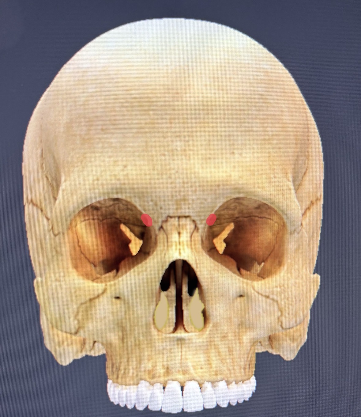 term image