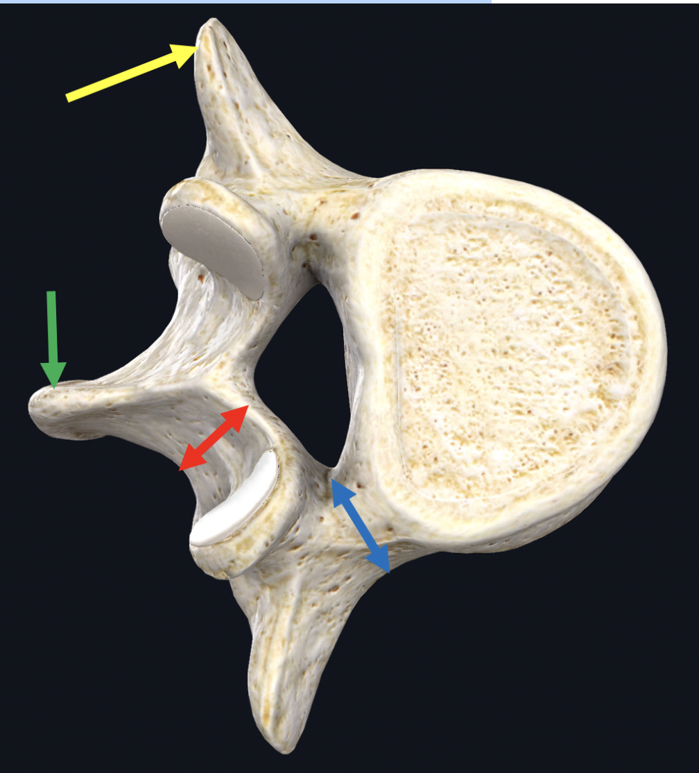 <p><span>Identify the structure at the tip of the yellow arrow</span></p>