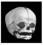 <p>newborn skull</p>