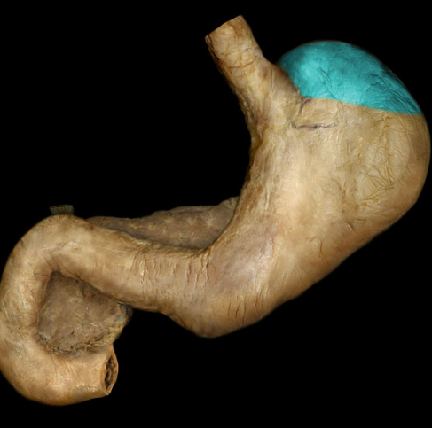 <p>bulges superior to and to the left of the cardiac orifice</p>