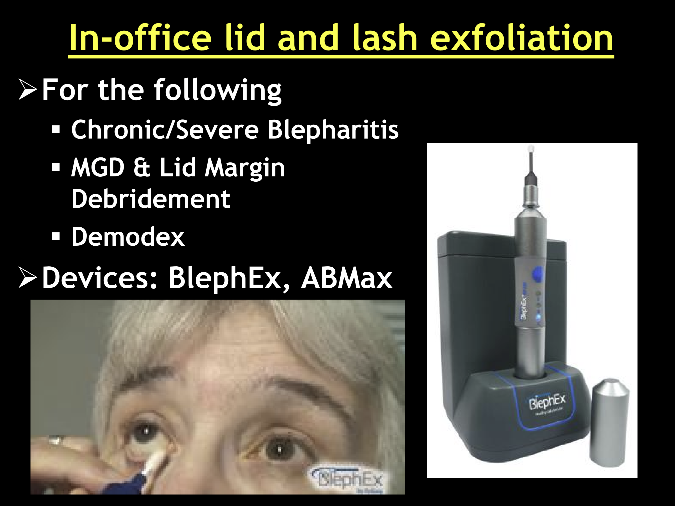 <ul><li><p>BlephEx</p></li><li><p>ABMax</p></li></ul><p></p>