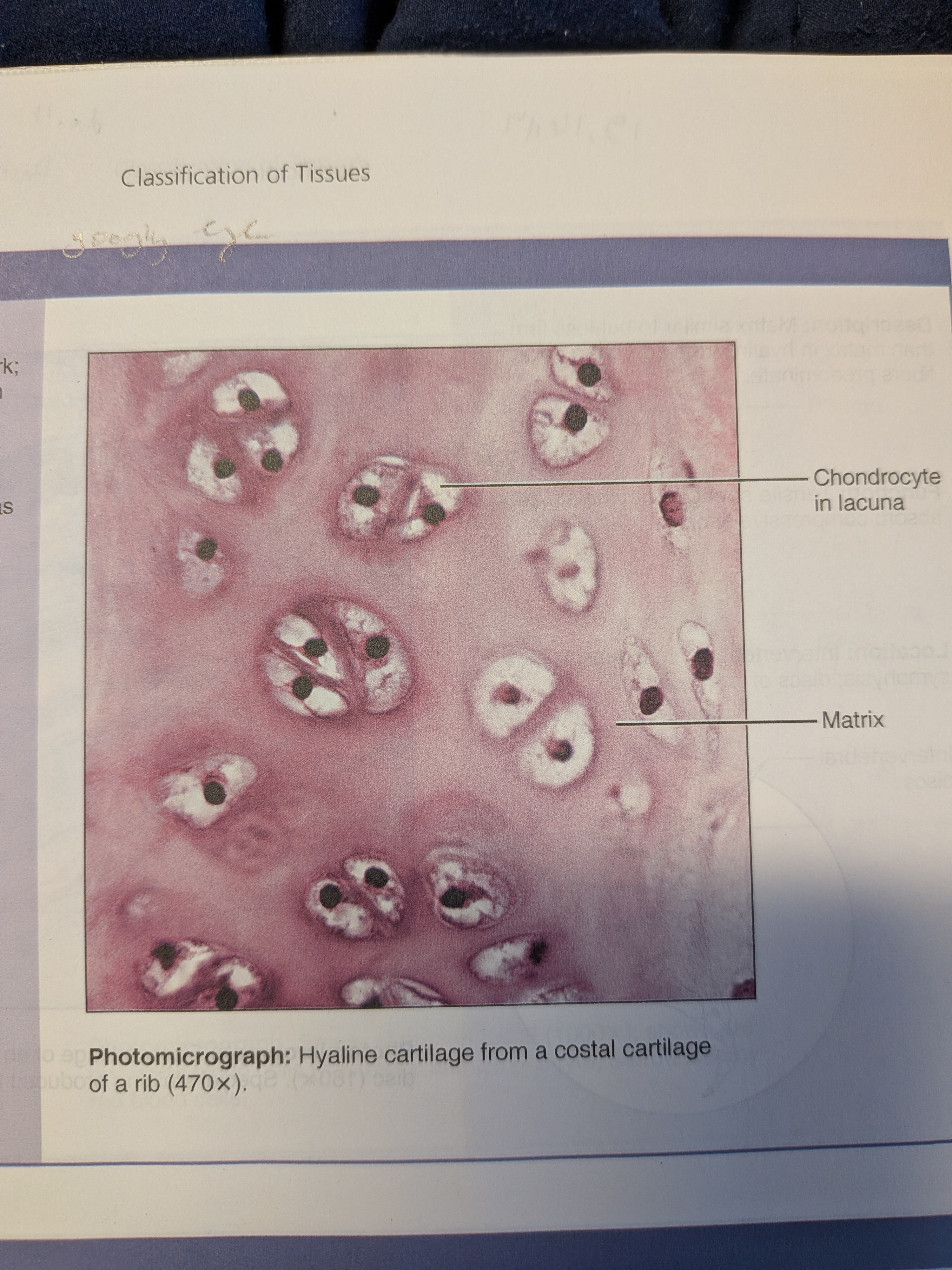<p>Cartilage: hyaline</p>