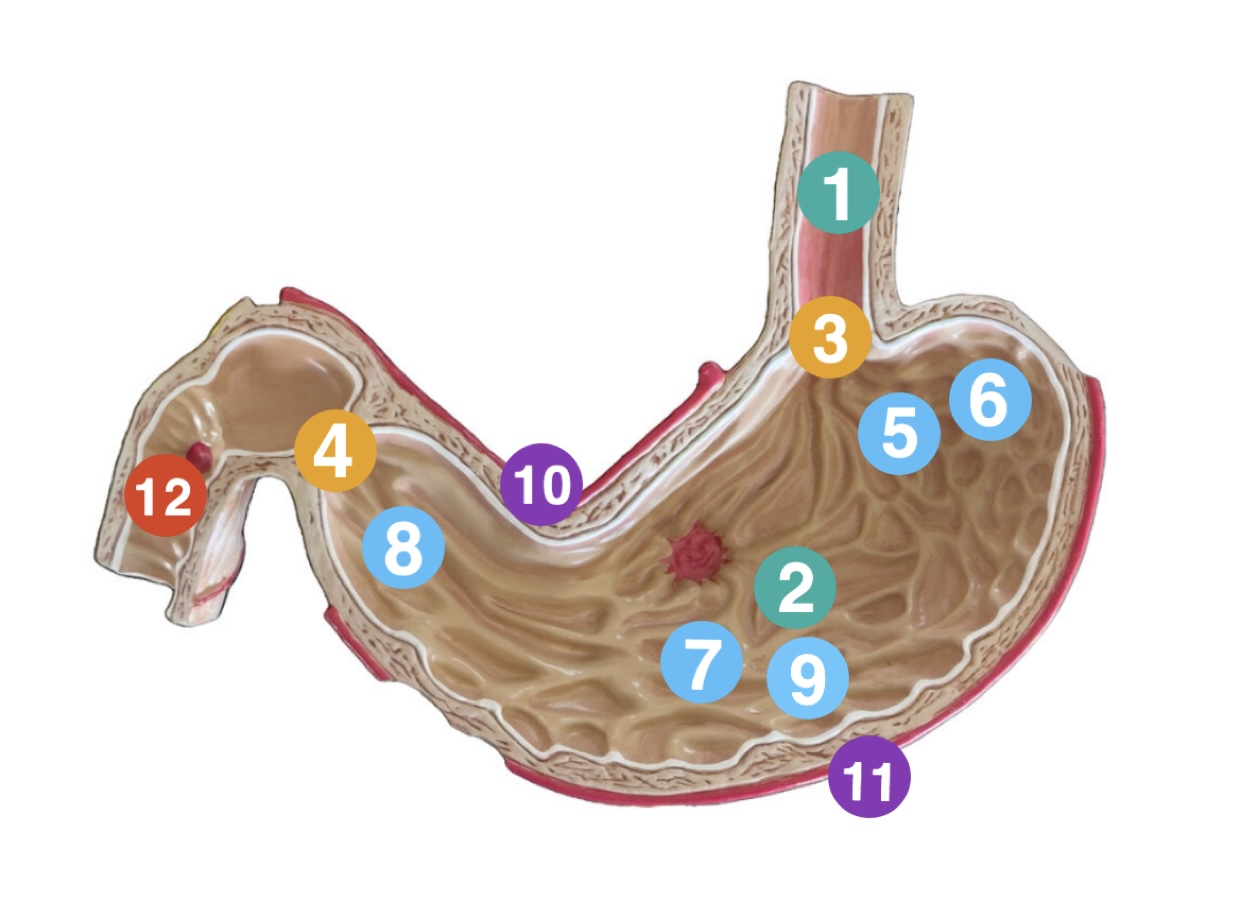 <p>Which region of the stomach is (7) pointing to?</p>