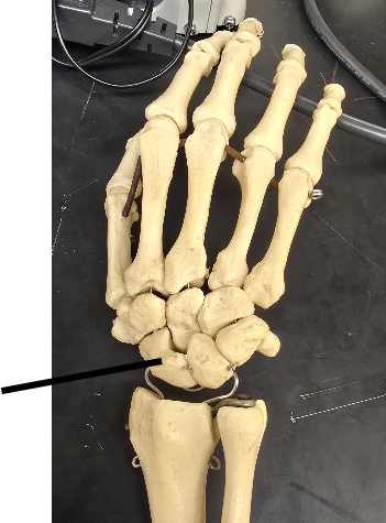 <p>Name Carpal Bone</p>