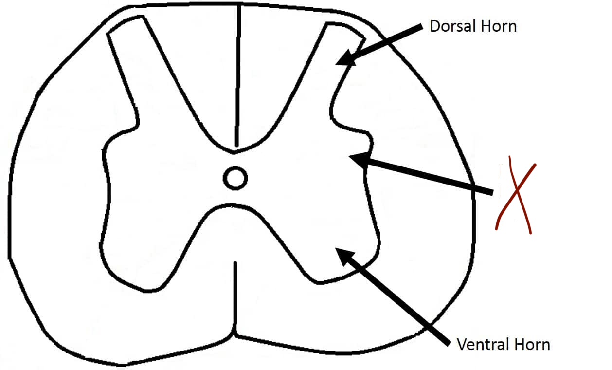 <p>Gray matter.</p><p>Autonomic motor neuron cell bodies.</p><p>Sympathetic output (T1–L2).</p>