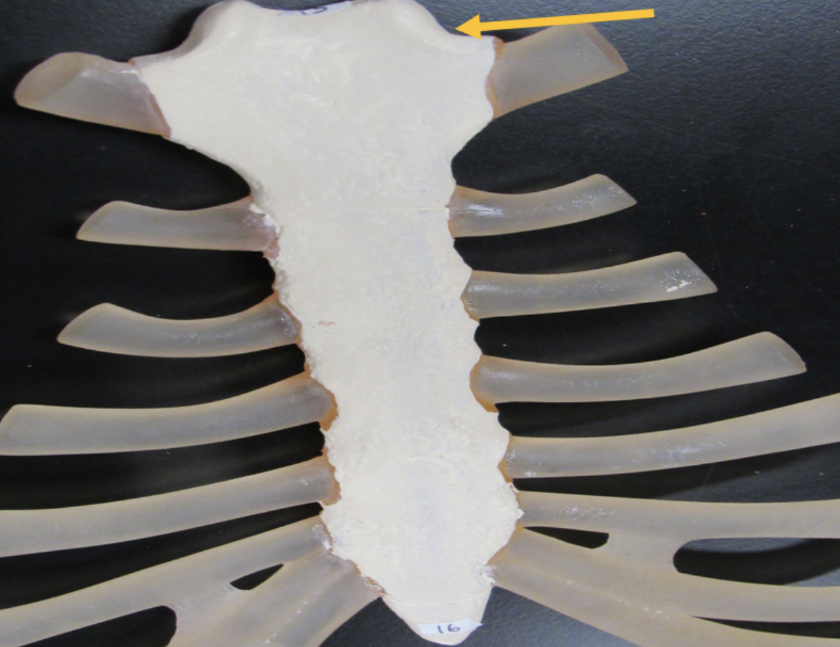 <p><span><strong>Identify the bone marking indicated by the pointer.</strong></span></p>