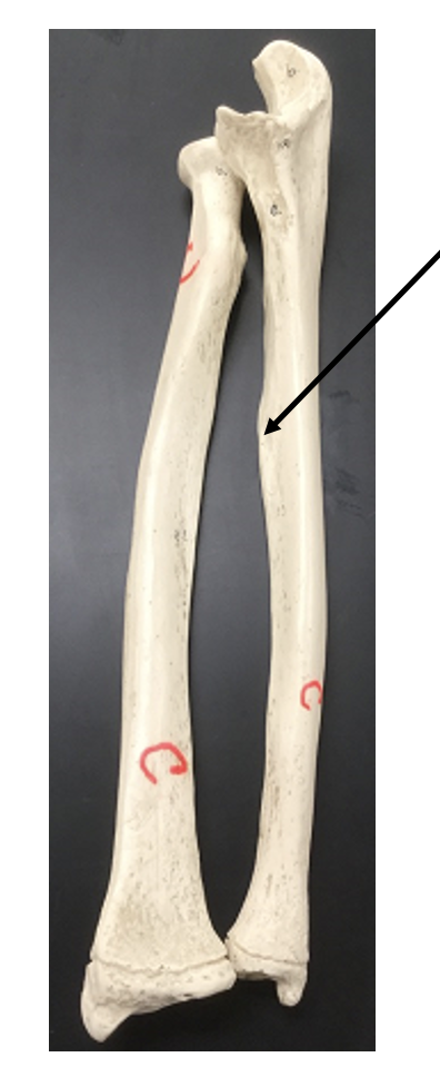 <p>What bone and bone feature is this?</p>