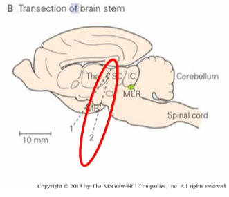 <p>transection made caudal to the mammillary bodies, no spontaneous stepping, electrical stimulation of the mesencephalic locomotor region is required to evoke walking.</p>