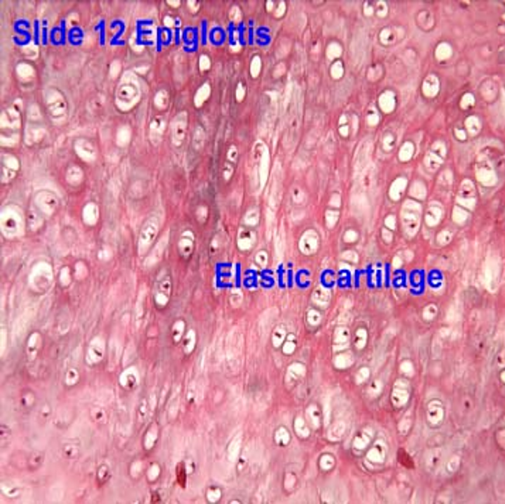 <p>Elastic cartilage</p>