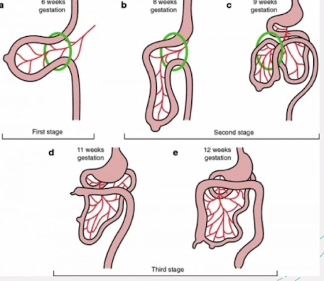 <ul><li><p>physiologic <span style="color: yellow;">midgut herniation </span>occurs between <span style="color: yellow;">8-12 weeks </span>gestation</p><ul><li><p>some of the bowel temporarily migrates into the base of the umbilical cord</p></li><li><p>around <span style="color: yellow;">12 weeks</span> gestation, bowel rotates and <span style="color: yellow;">returns</span> back into the abdominal cavity</p></li></ul></li></ul><ul><li><p>if this process (normal development of abdominal wall) does not occur correctly, abdominal organs may remain at the base of the umbilical cord, leading to abdominal wall abnormalities</p></li></ul><p></p>