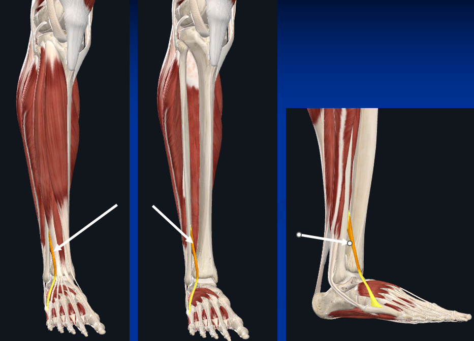 <p>There are 3 different "peroneal" muscles. To which peroneal muscle are the arrows in the following picture pointing:</p>