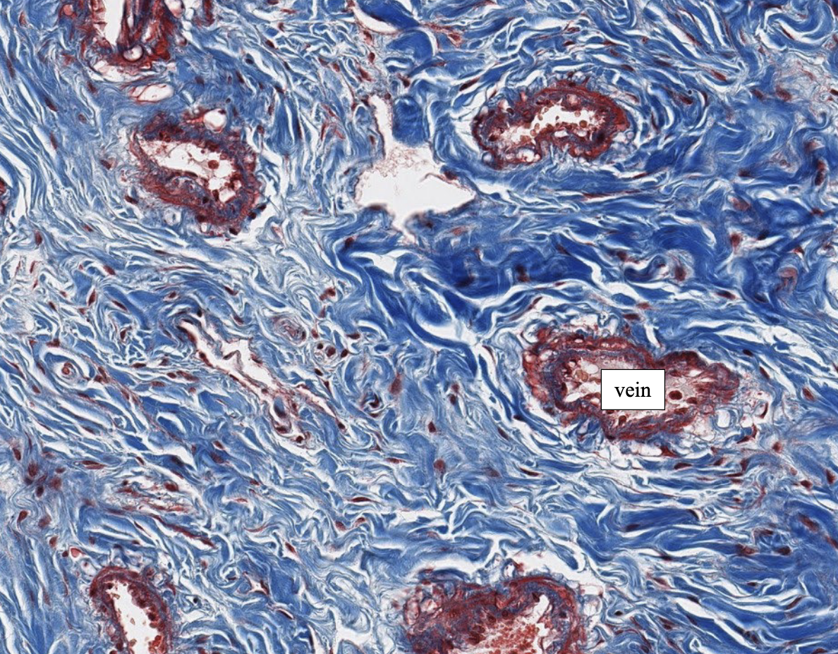 <p>ID the type of CT shown in the image</p>