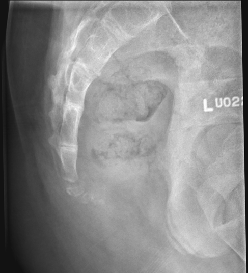 <p>critique this coccyx lateral</p>