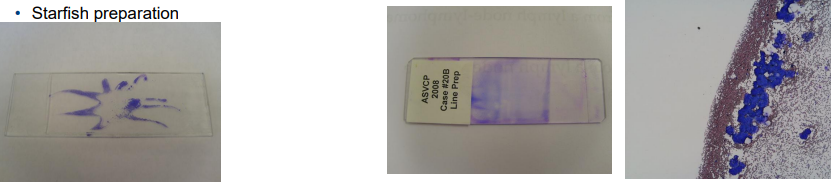 <p>» May use the same technique for smearing as solid mass aspirates- just place a drop of well mixed fluid (gently inverted – not shaken) in the same area that you would place the sample and spread in the same method</p><p></p><p>» Alternative spreading</p><p>• Line preparation- blood smear technique but abruptly stop and lift up the spreader smear</p><p>• Starfish preparation - if liquid is gloopy so you can take a needle gently raise the top slide and spread out the liquid</p>