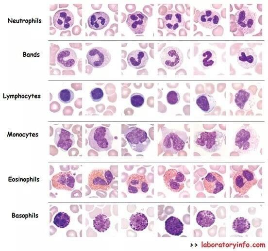 <p><span><strong>Neutrophil</strong>: 3–5 nuclear lobes | Pale pink cytoplasm | Fine granules.</span></p><p><span>-</span></p><p><span><strong>Lymphocyte</strong>: Huge round nucleus | Thin blue halo of cytoplasm | Smallest size.</span></p><p><span>-</span></p><p><span><strong>Monocyte</strong>: Kidney/U-shaped nucleus | Gray-blue cytoplasm | Largest size.</span></p><p><span>-</span></p><p><span><strong>Eosinophil</strong>: 2 nuclear lobes | Bright red/orange granules | Medium size.</span></p><p><span>-</span></p><p><span><strong>Basophils</strong>: Obscured nucleus | Dark purple/black granules | Medium size.</span></p><p></p>