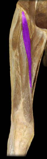 <p>hip flexion, abduction, external rotation</p>