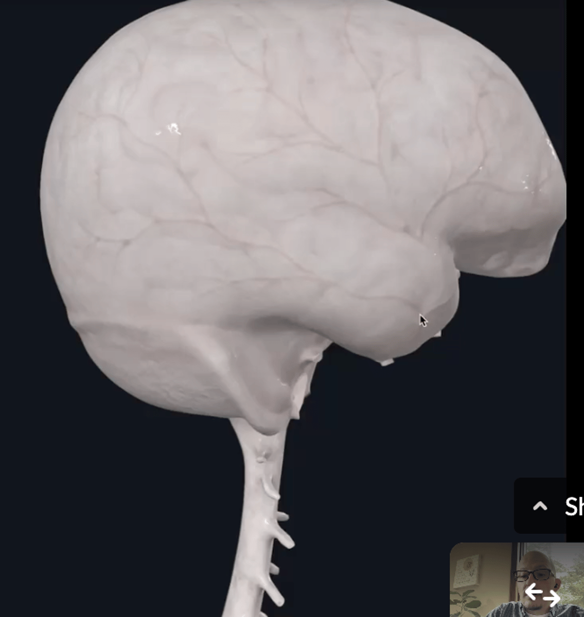 <p>What are the red veins?</p>