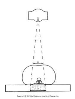 <ul><li><p>Because the beam widens as it gets the farther from the source:</p></li><li><p>More tissue is exposed as the beam exits the patient than at the anterior skin surface</p></li><li><p>This also accounts for <u>magnification</u></p></li></ul><p></p>