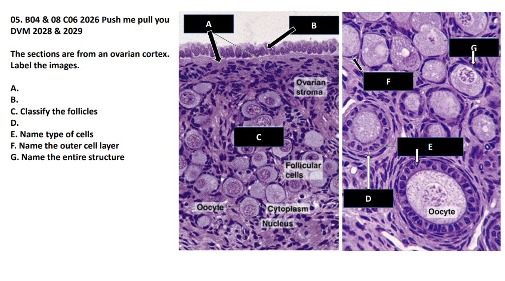 <p>A.</p><p>B.</p><p>C. Classify the follicles</p><p>D.</p><p>E. Name type of cells</p><p>F. Name the outer cell layer</p><p>G. Name the entire structure</p>