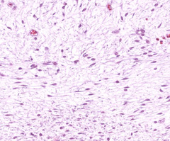 <p>What type of connective tissue is pictured?</p>