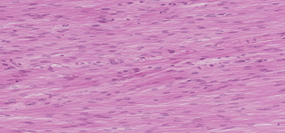 <p>Smooth muscle </p>