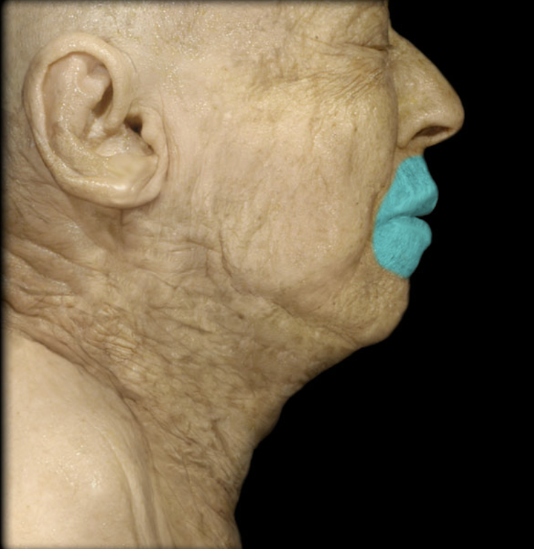 term image