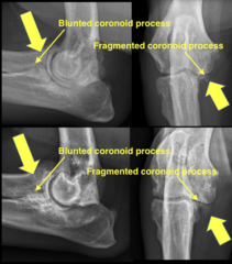 <p>blunting of the medial coronoid process or a fragment</p>