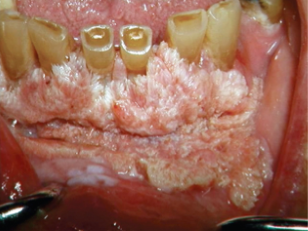 <p>what is this condition</p>