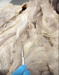 <p>Name the Muscle</p>