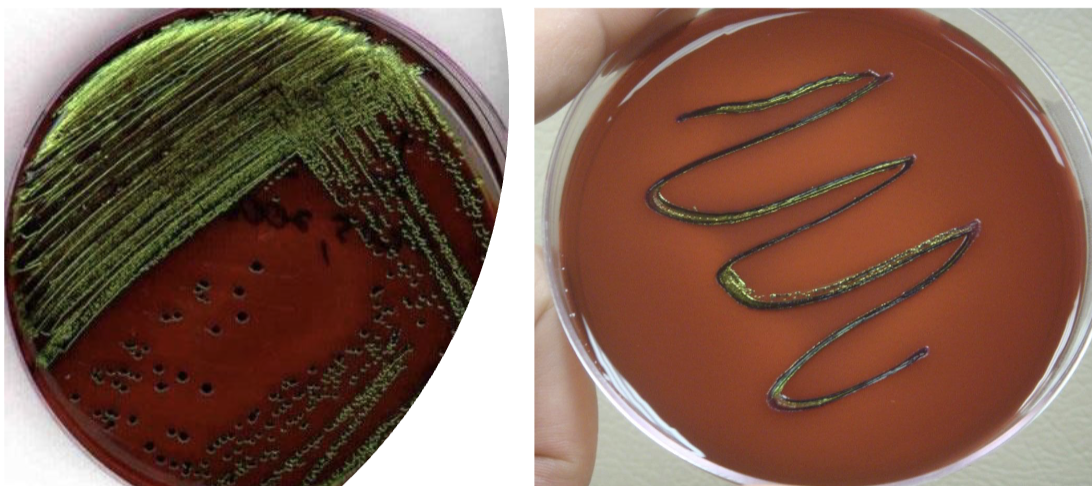 <p>what type of agar?</p>