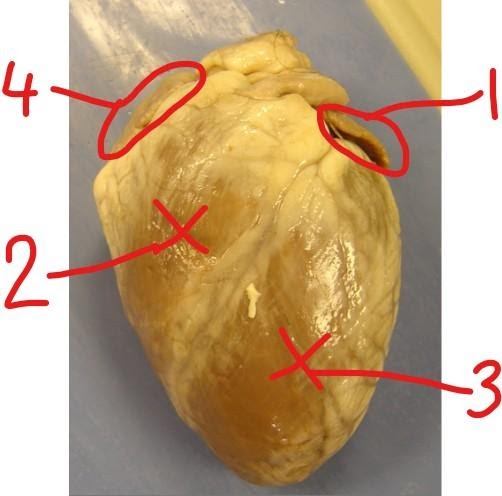 <p>which structure is the right atrium? </p>