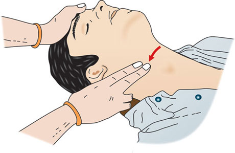 <p>Name this Pulse Site:</p><p>(Neck)</p>