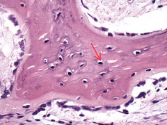 <p>What is indicated by the arrow?</p>