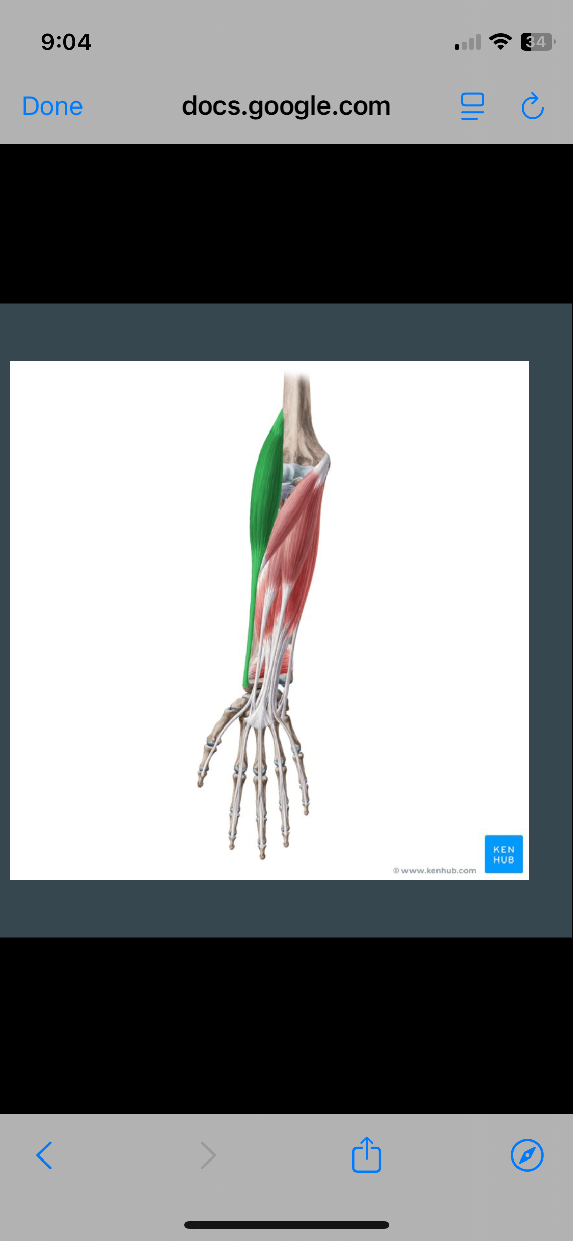 <p>Brachioradialis</p>