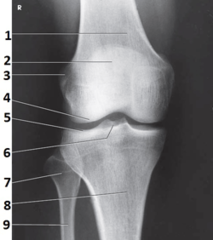 <p>Examine the image below. What anatomy is indicated by the number 1?</p>