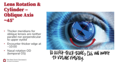 <p>When a CLs has an oblique axis of 45º, the thicker meridian will be _____ to the upper eyelid</p>