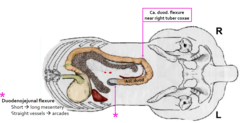 <p>there is a change from short mesentery to the long mesentery</p>