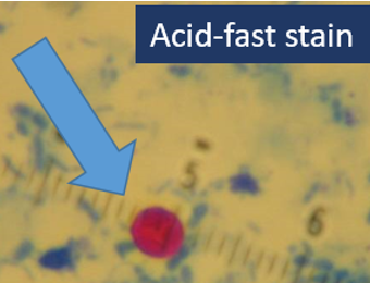 <p>Dogs (C. canis*), Pigs (C. suis*), Calves &amp; Lambs (<u>C. parvum</u>*), Birds (C. meleagridis), <br>Humans (<u>C. hominis </u>&amp; C. cuniculus, and *) - <u>most important</u>.</p>