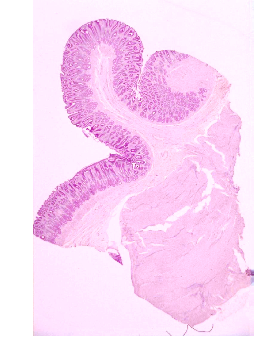 <p>welk preparaat en kleuring?</p>