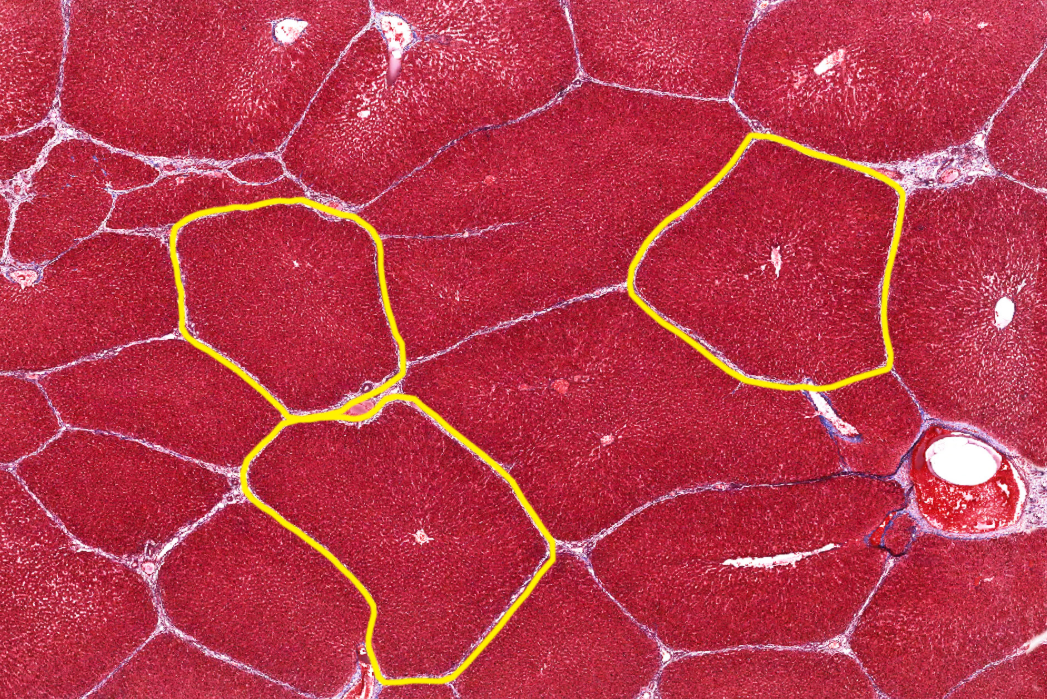 <p>Liver</p><p><strong>NOTICE: THE TIGHTLY PACKED HEPATOCYTES FORMING THE UNIQUE HEXAGONAL SHAPE OF THE LOBULES AND THE LIVER SINUSOIDS THAT SUPPLY THEM WITH NUTRIENTS</strong></p>